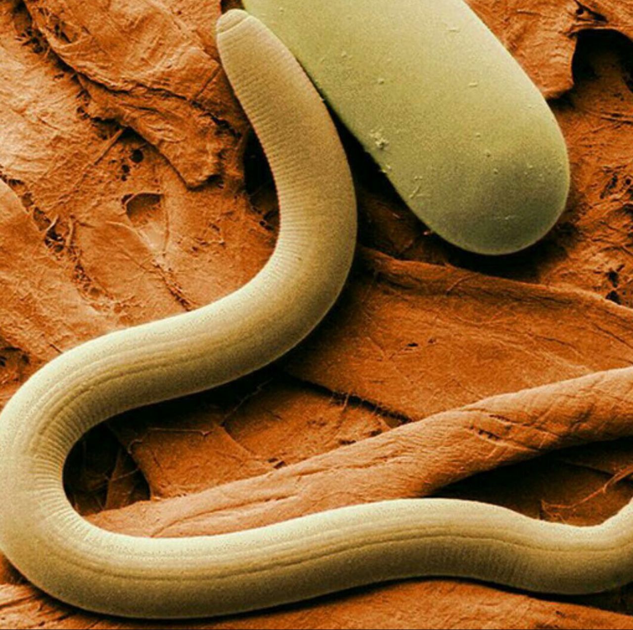 کرم لوله‌ای میکروسکوپی «نماتود»