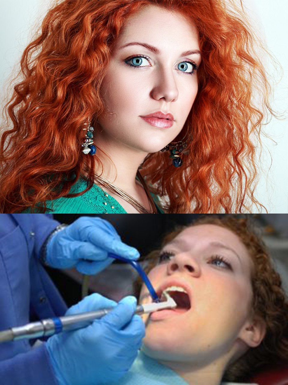 آستانه تحمل درد موقرمزها