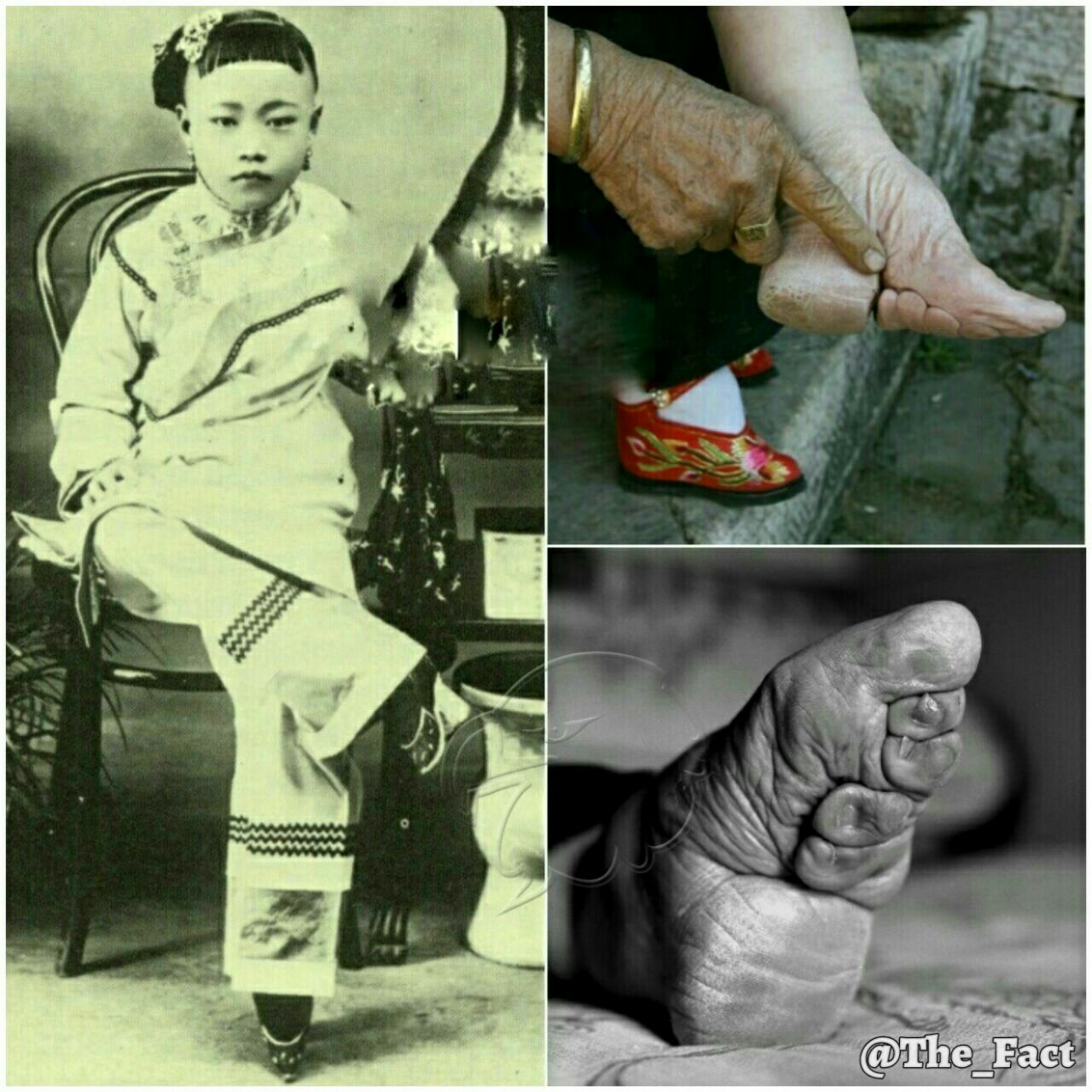 علت پاهای کوچک دختران درچین قدیم