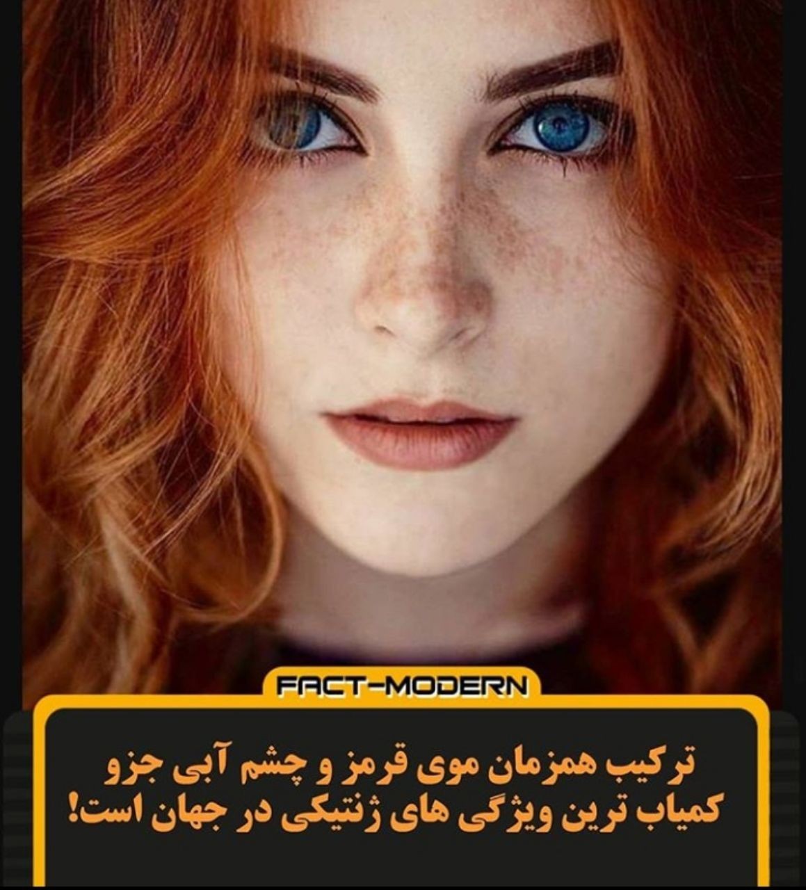 موی قرمز وچشم آبی