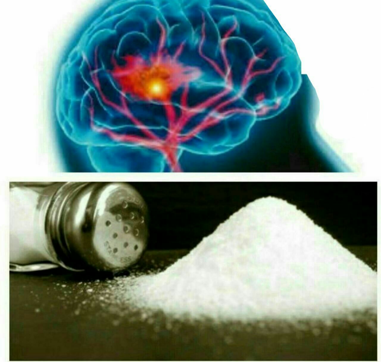 دلیل زوال عقل