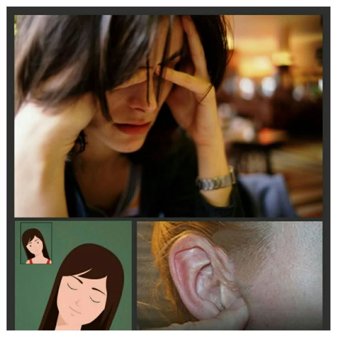 تکنیک از بین بردن سرگیجه