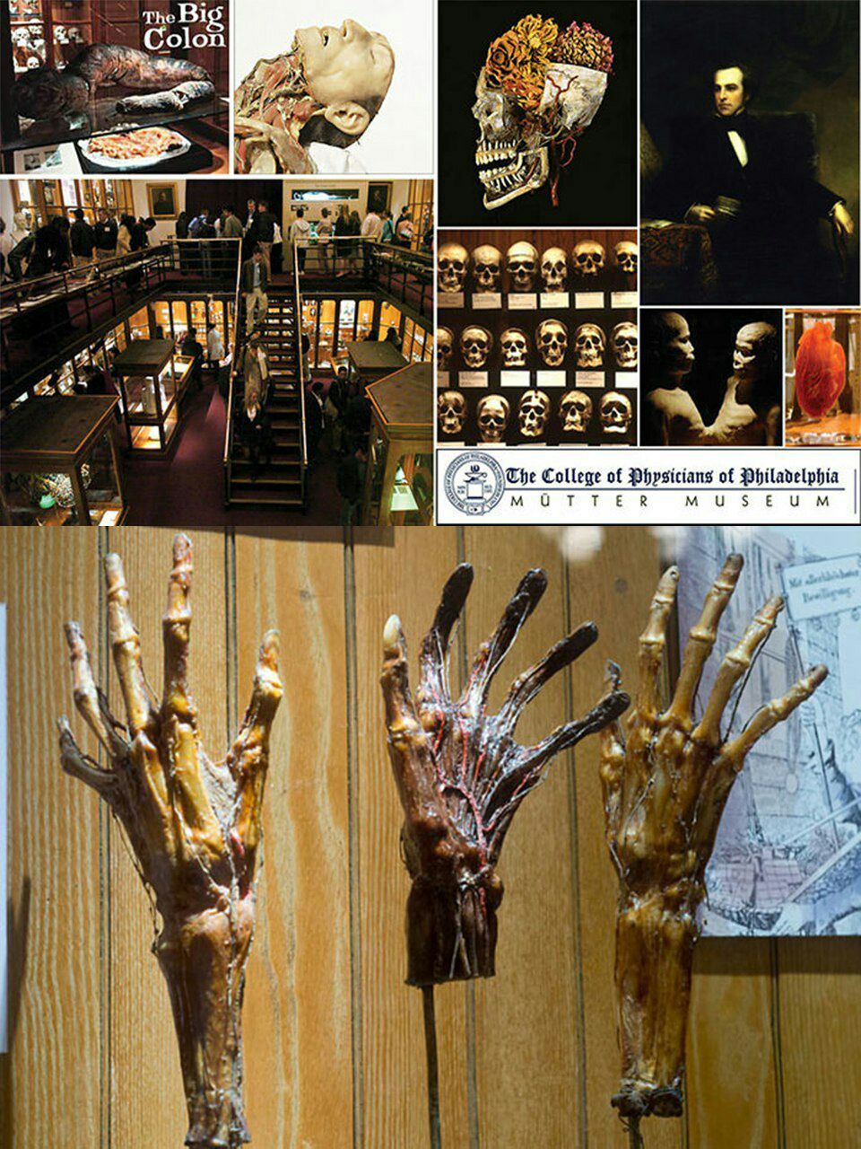 موزه اعضای بدن افراد مشهور