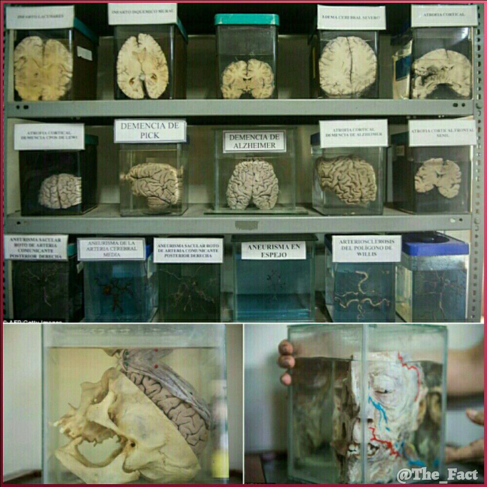 موزه مغز در پرو