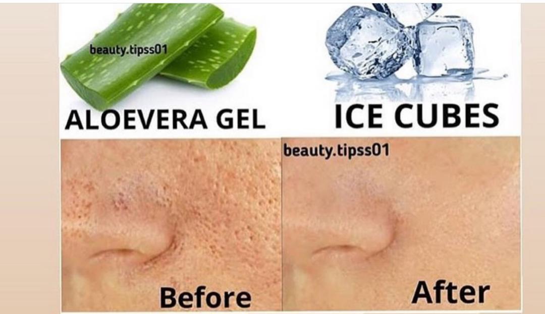 منافذ باز در پوست