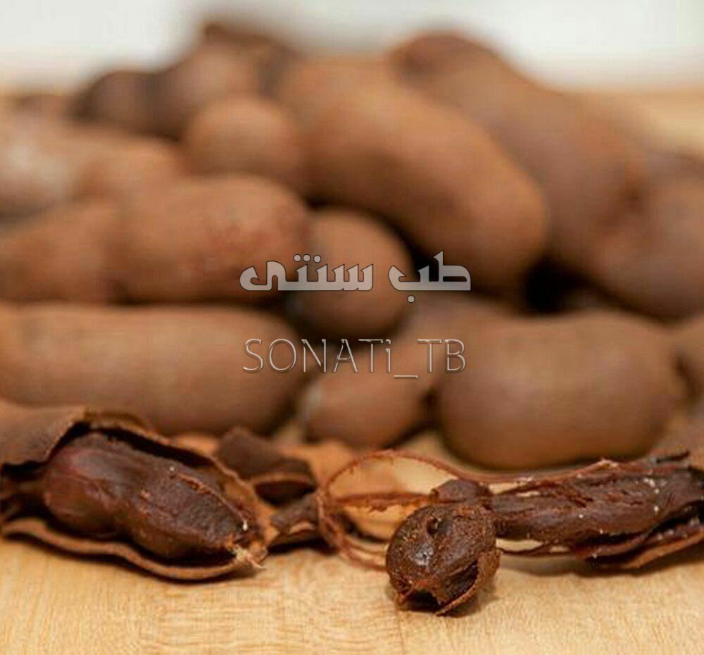 درمان سنگ صفرا