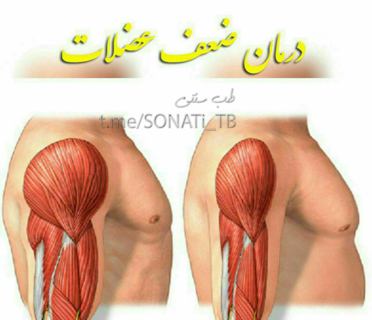 درمان ضعف عضلات
