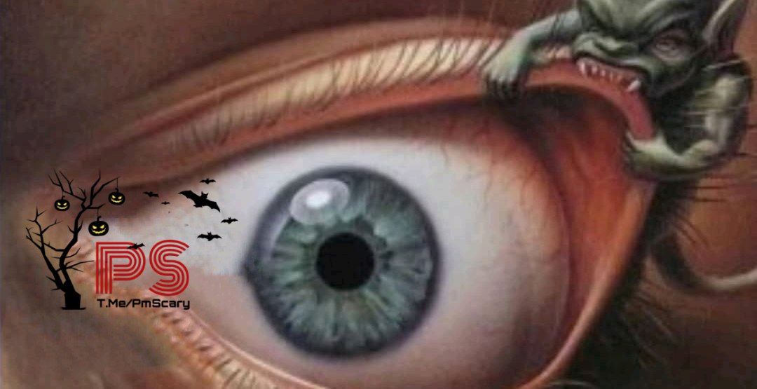 اختلال fetal insomnia 