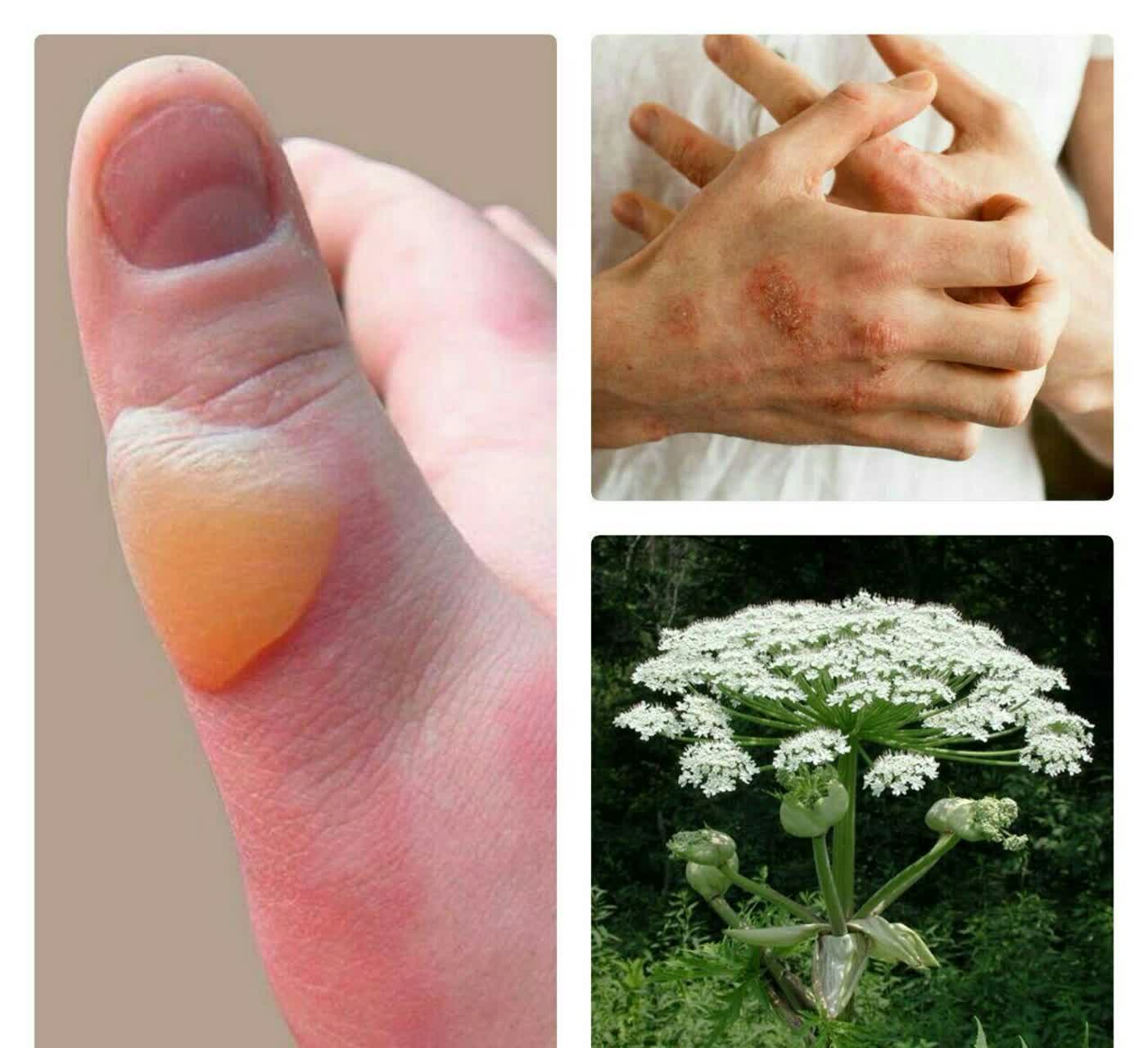 خطرناکترین گیاه جهان