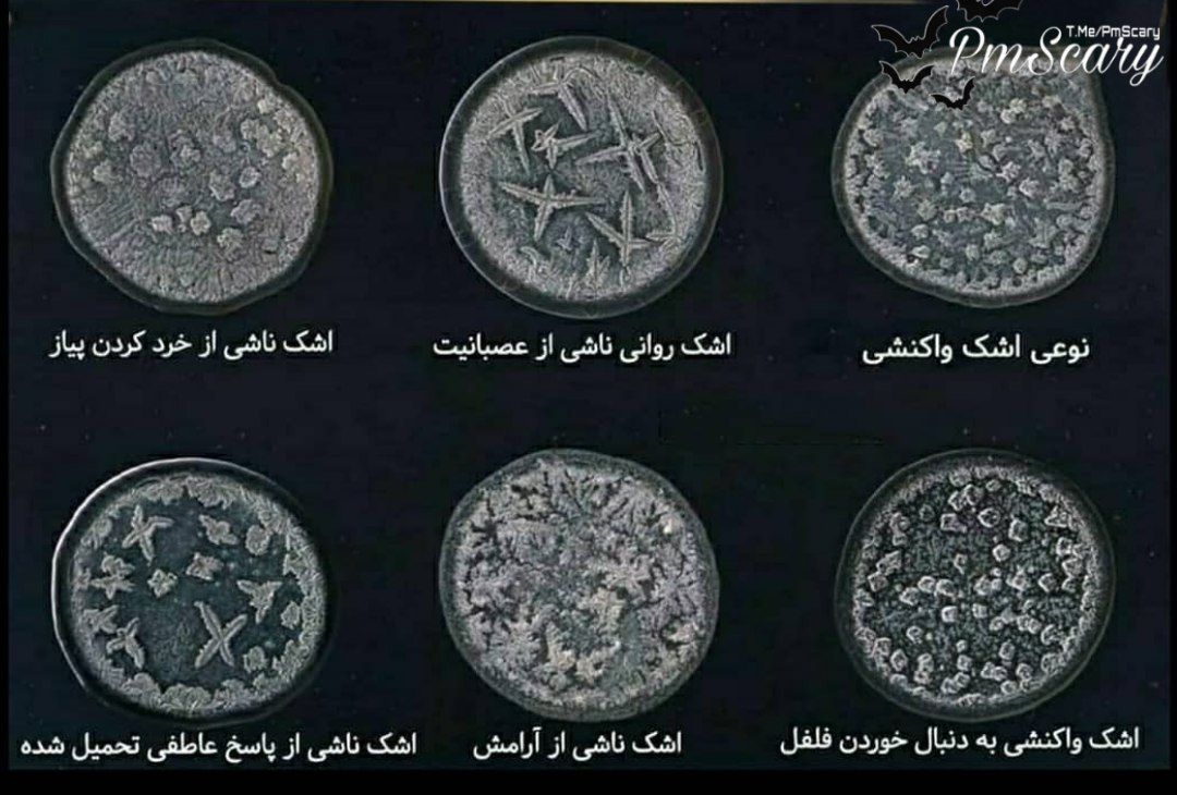 تصاویر قطرات اشک انسان زیر میکروسکوپ