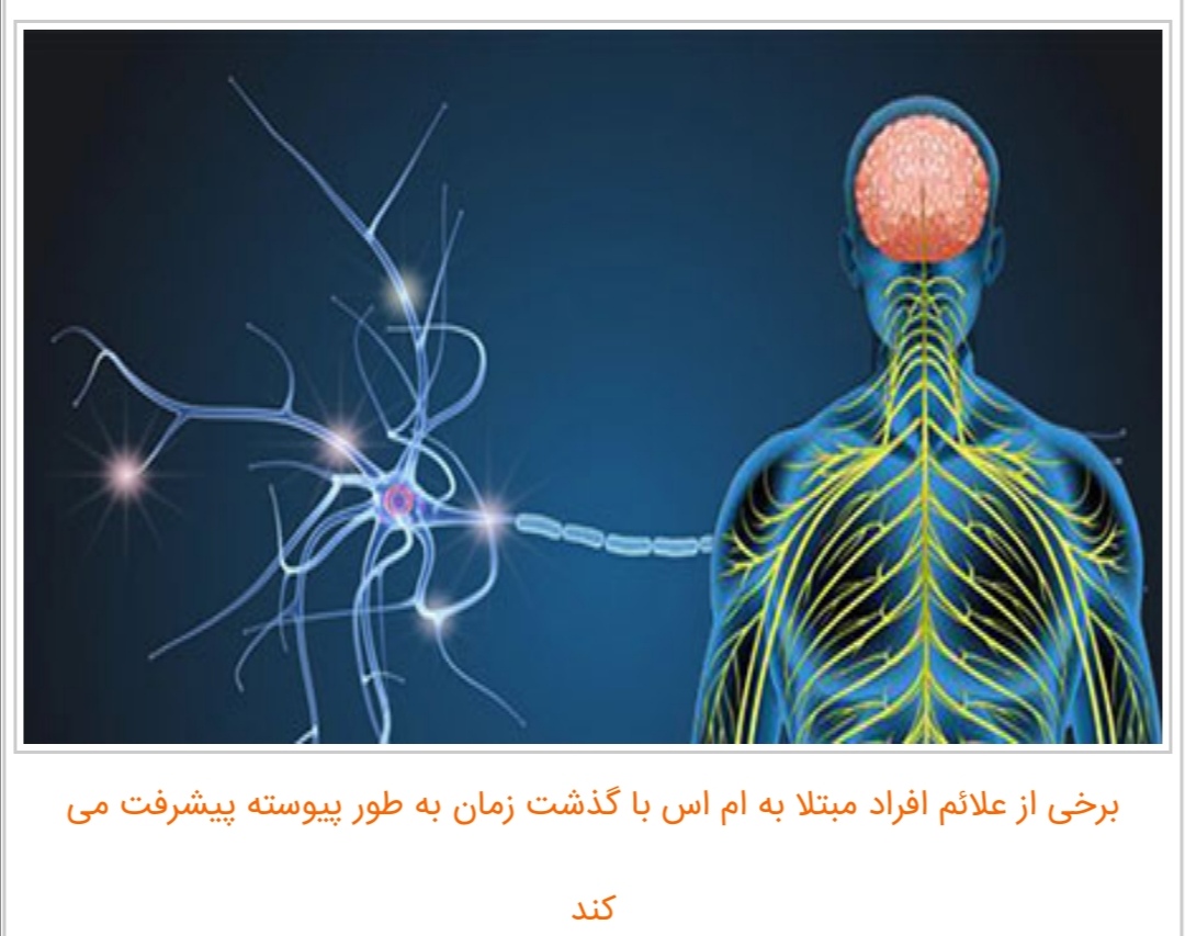 نشانه های ام اس (MS)