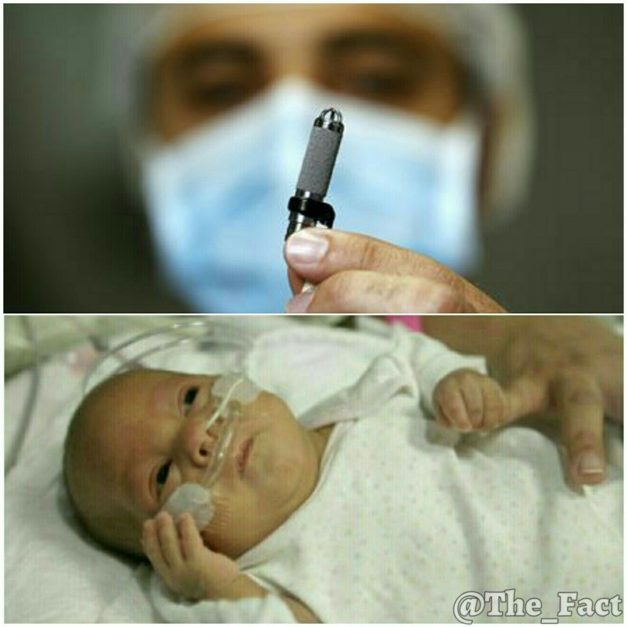 کوچکترین قلب مصنوعی دنیا