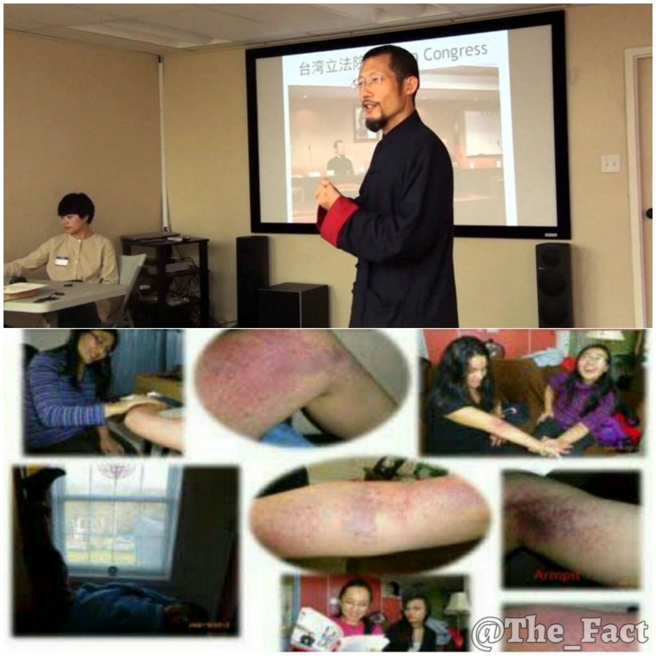 درمان بیماری یک مردچینی با کتک زدن 