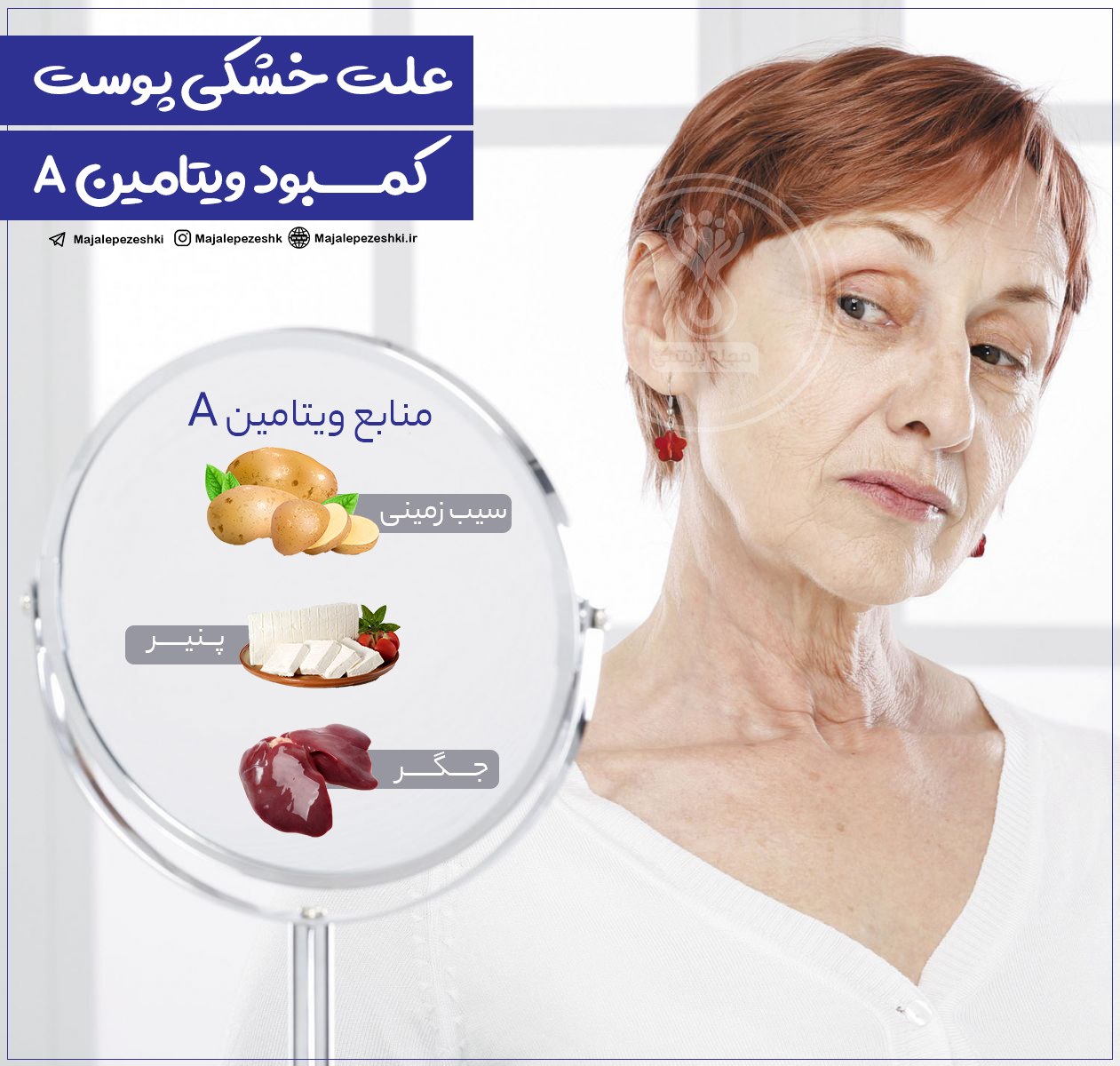 علت خشکی پوست