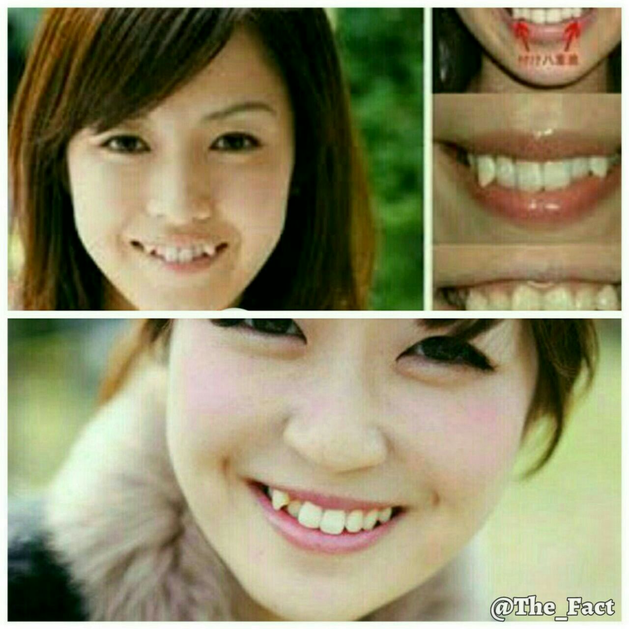 (یائه با )کج کردن دندان نیش خانمهای ژاپنی