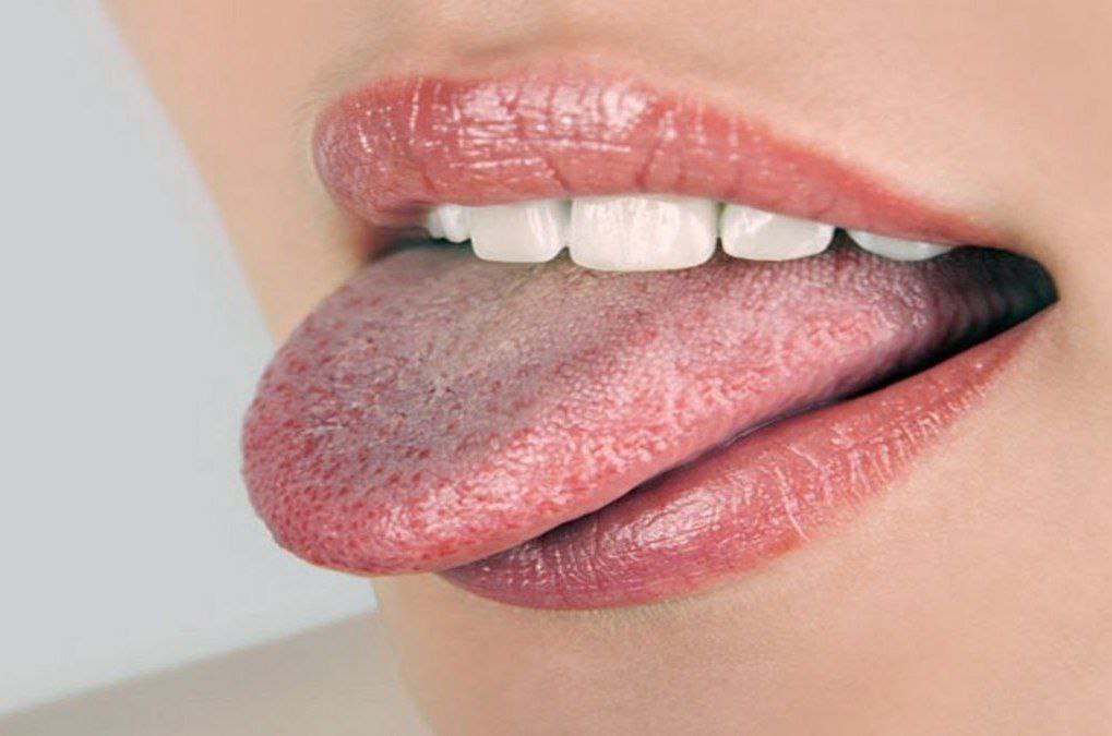 زبان قرمز روشن