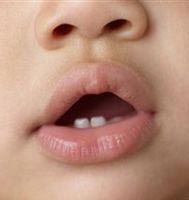 علائم دندان درآوردن کودکان