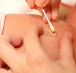 با عفونت ناف نوزادان چه کنیم