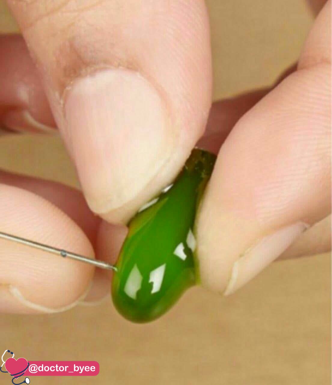 رفع چروک دور چشم  