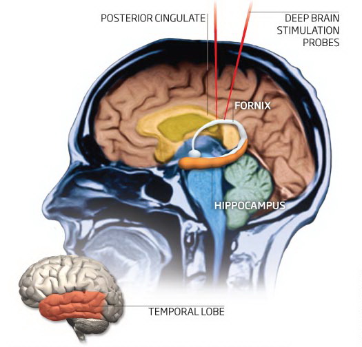 گاهی مغزتان دروغ می‌گوید
