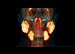 عجیبه در قرن ۲۱ هنوز اعضایی از بدن ما کشف نشده