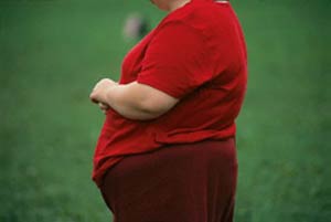 چاقی ، عمر مبتلایان به سرطان سینه را کم می کند