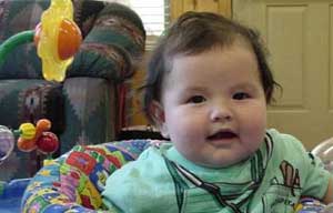 پوسیدگی دندانهای شیرخواران