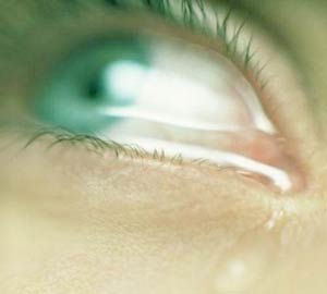 ریزش اشک‌ از چشم‌ها