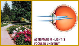 آستیگماتیسم Astigmatism