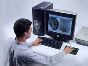 جلوگیری از سقط جنین