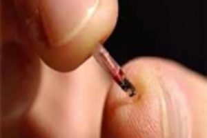 کار گذاستن تراشه در زیر پوست کارمندان