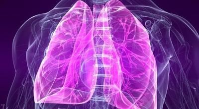 علائم بروز مشکل در ریه ها