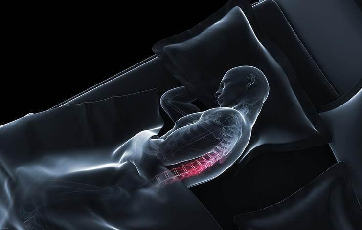 معرفی کمر دردهای مهلکی که باید جدی بگیریم