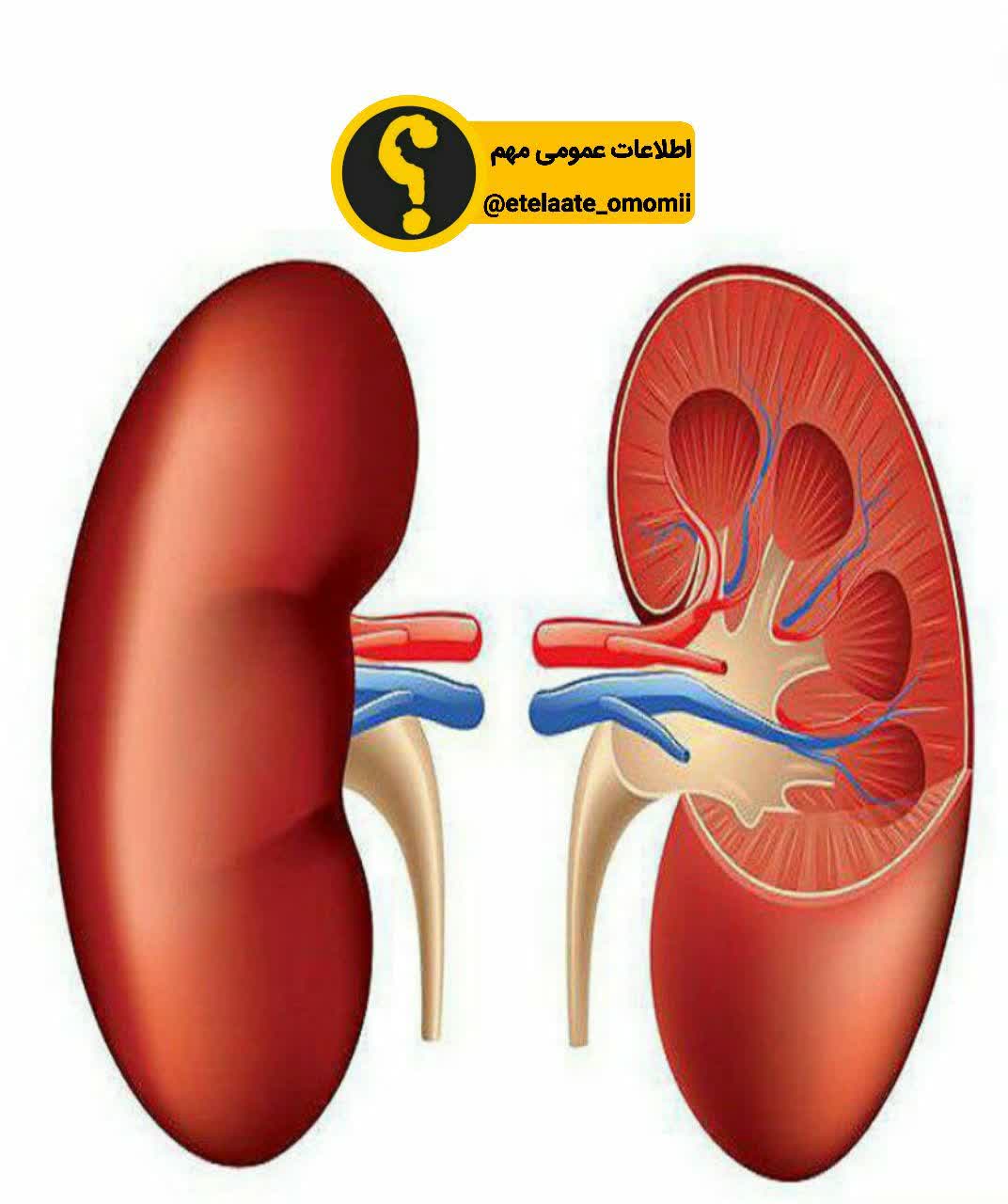 راه های دفع سنگ‌ کلیه را میدانید