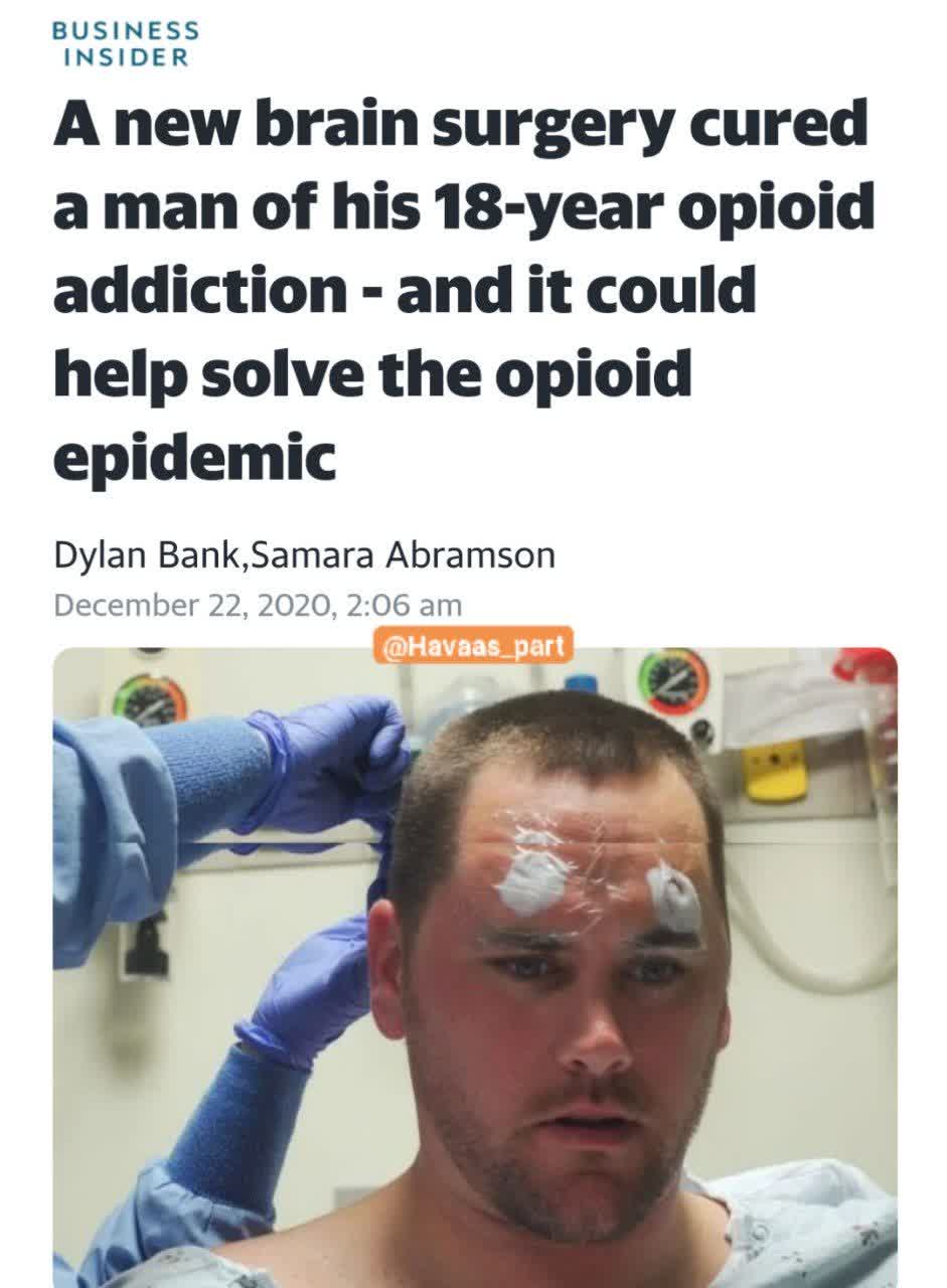 معتادها با جراحی مغز پاک می‌شوند