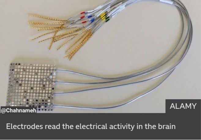 فعالیت الکتریکی مغز