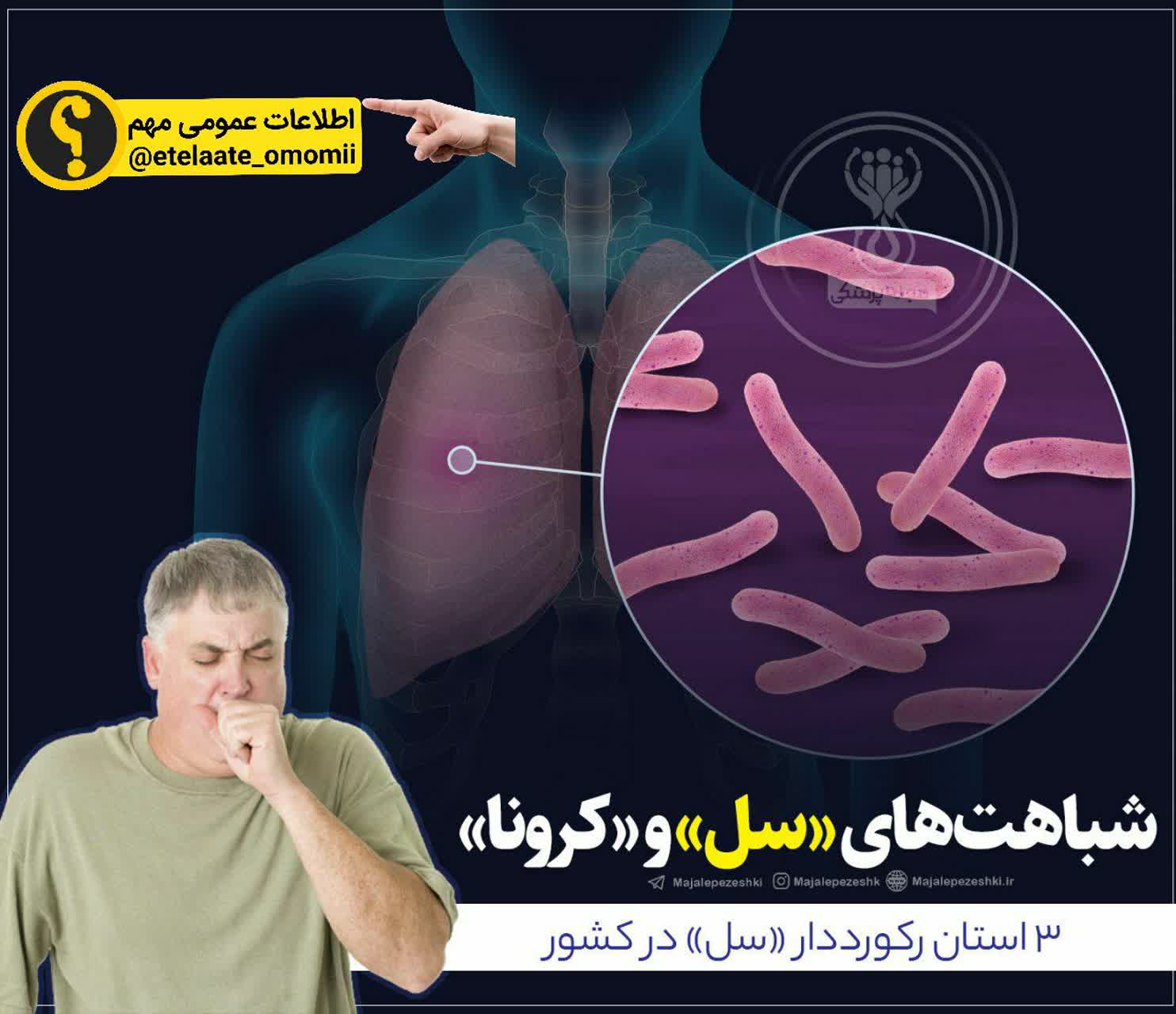 دو بیماری سل و کرونا