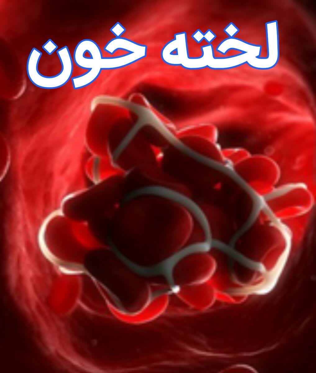 علایم لخته شدن خون