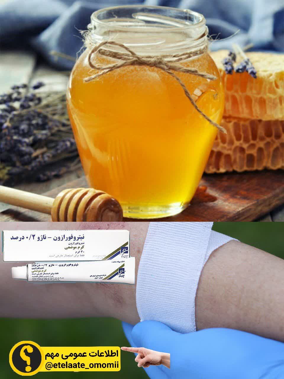 بهترین پماد ضدسوختگی جهان عسل!