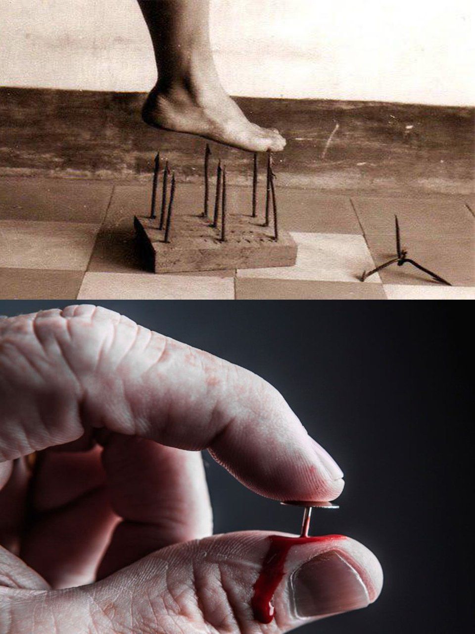 بیماری عدم حساسیت به درد