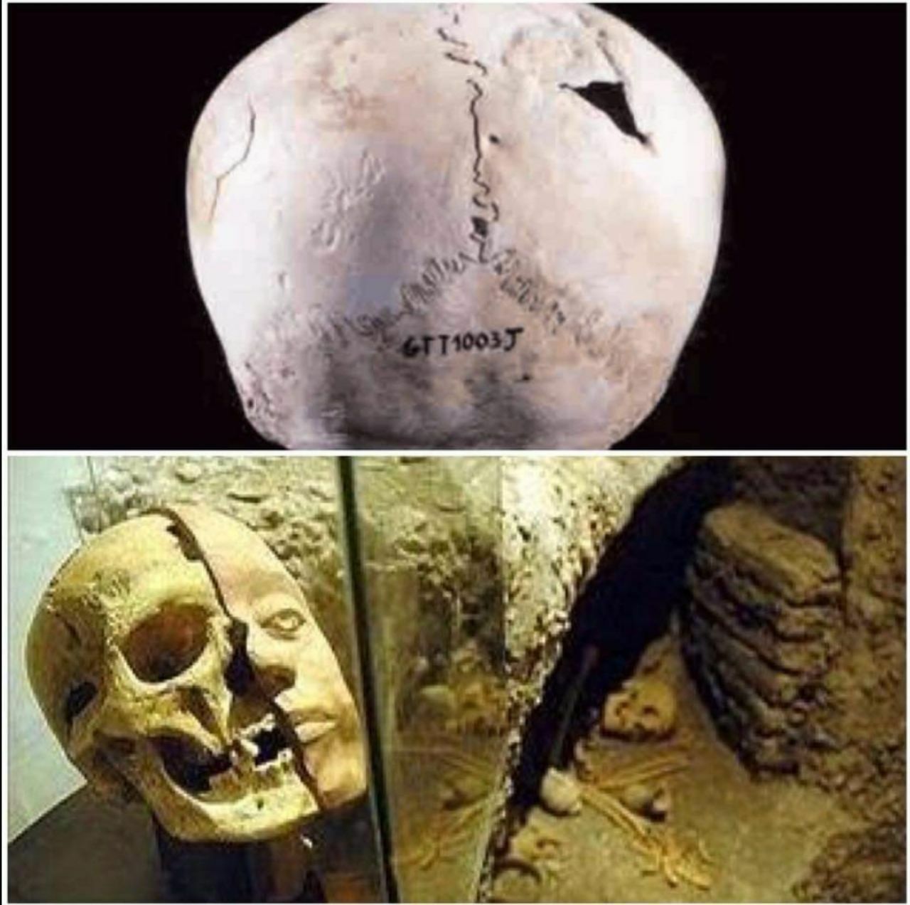 اولين جراحي مغز تاريخ در ايران