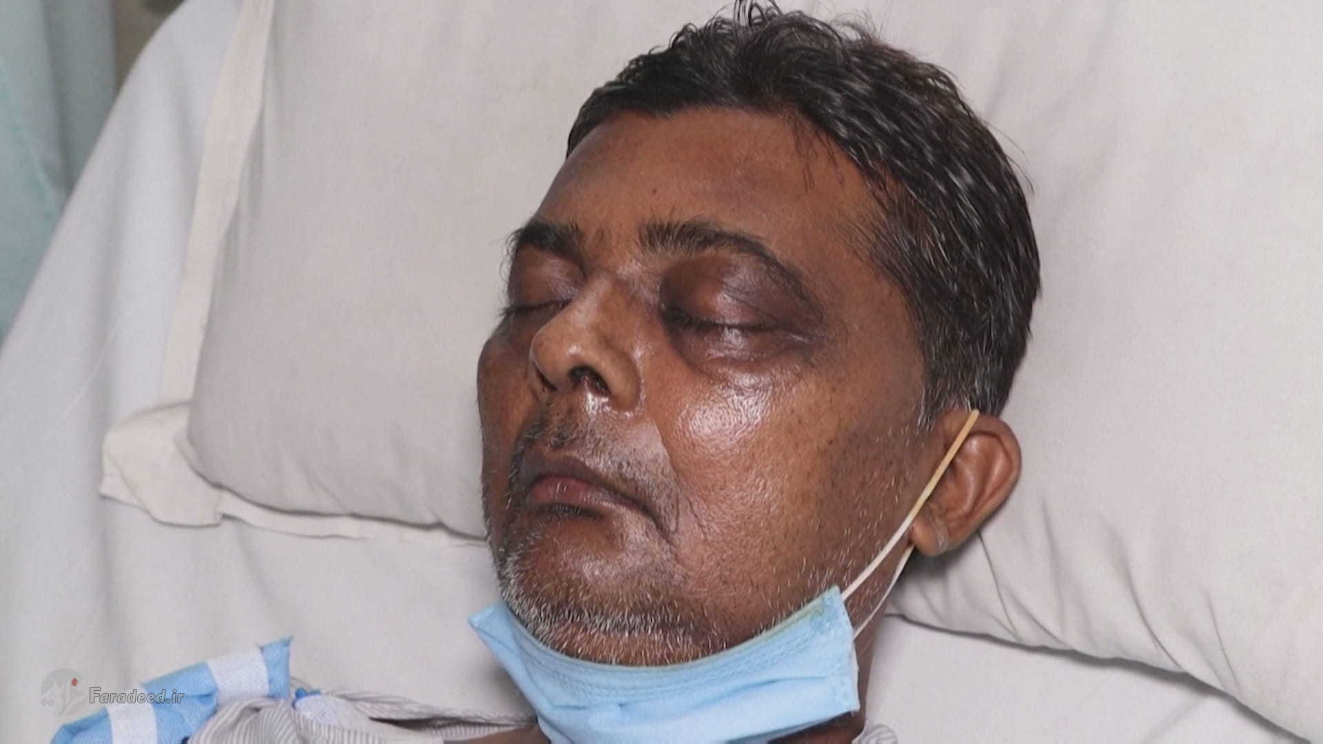 قارچ سیاه چیست وچگنه انتقال داده میشود