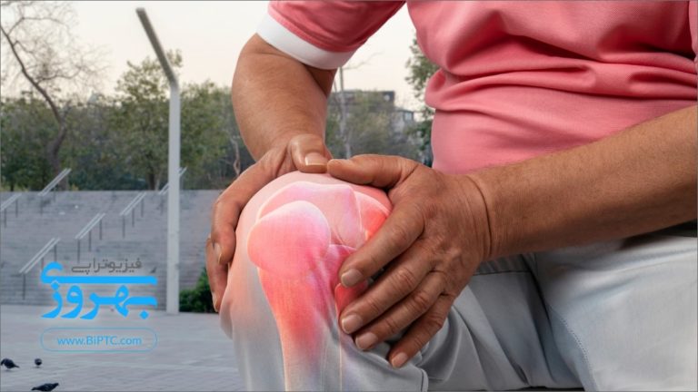 فیزیوتراپی زانو و درمان زانودرد